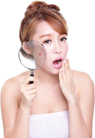 Nguyên nhân gây mụn Nguyên nhân gây mụn